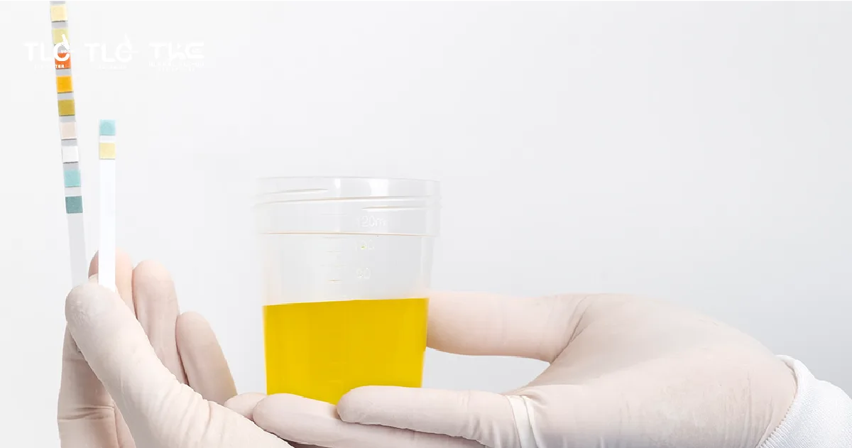 คีโตน Ketones