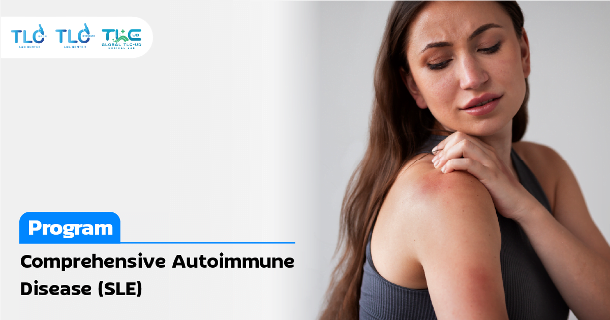 Comprehensive Autoimmune Disease (SLE)