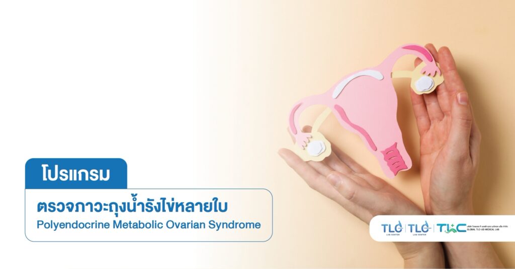 ตรวจภาวะถุงน้ำรังไข่หลายใบ