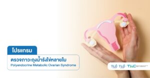 ตรวจภาวะถุงน้ำรังไข่หลายใบ