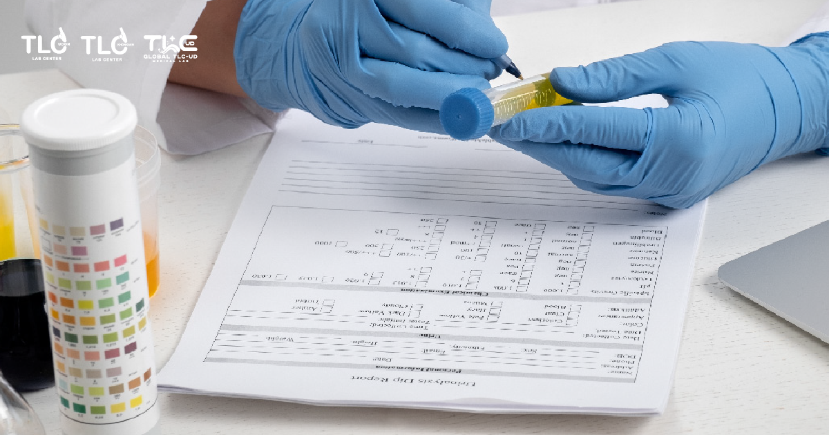 Urine indican