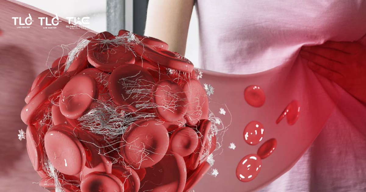 การควบคุมการอักเสบ - Inflammation control