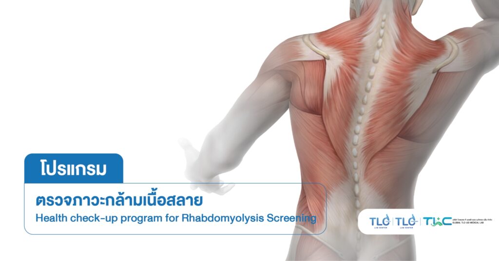 ตรวจ ภาวะกล้ามเนื้อสลาย - Rhabdomyolysis Screening
