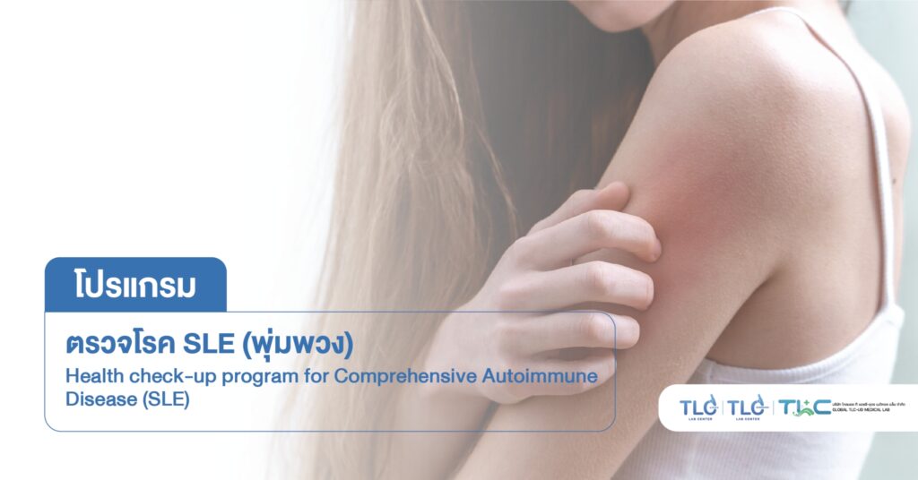 ตรวจคัดกรองโรค SLE (โรคพุ่มพวง) Comprehensive Autoimmune Disease (SLE)