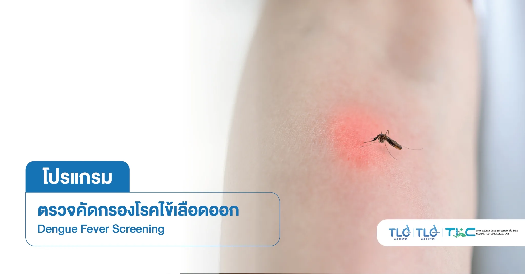 ตรวจคัดกรองโรค ไข้เลือดออก - Dengue Fever Screening