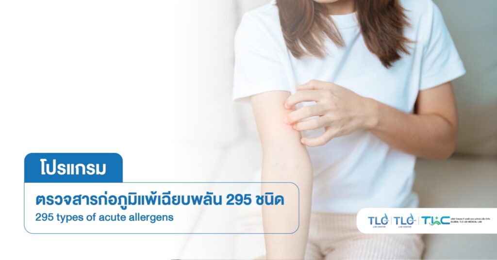 ตรวจสารก่อ ภูมิแพ้เฉียบพลัน 295 ชนิด - 295 types of acute allergens