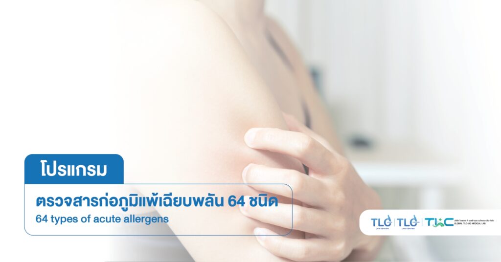 ตรวจสารก่อ ภูมิแพ้เฉียบพลัน 64 ชนิด - 64 types of acute allergens