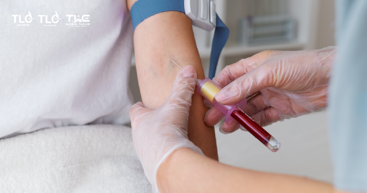ตรวจเลือด Blood Testing