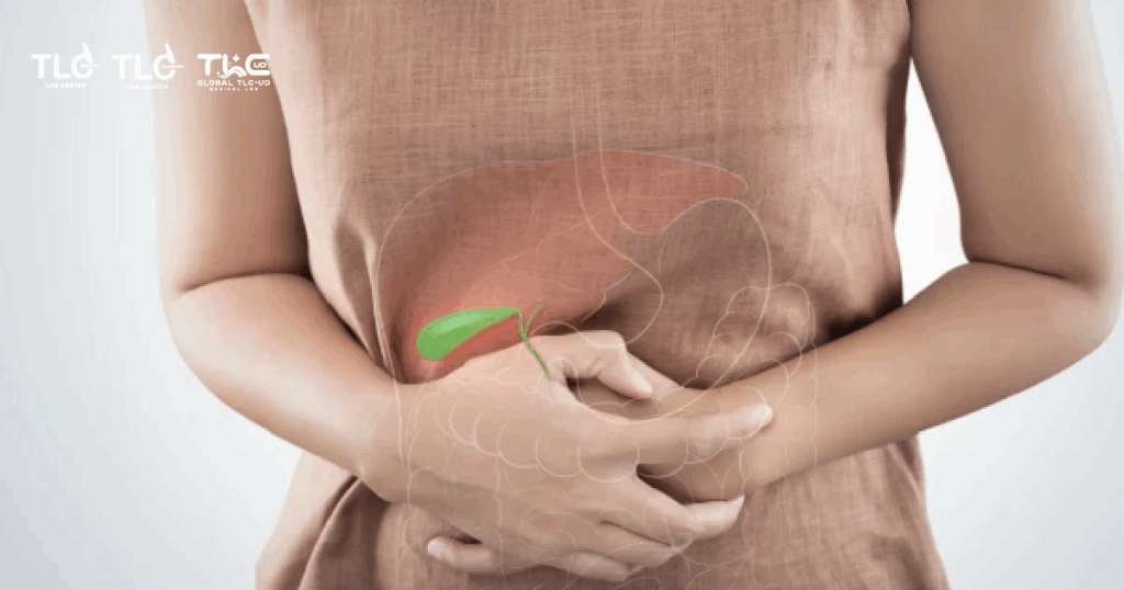 นิ่วในถุงน้ำดี gallstones