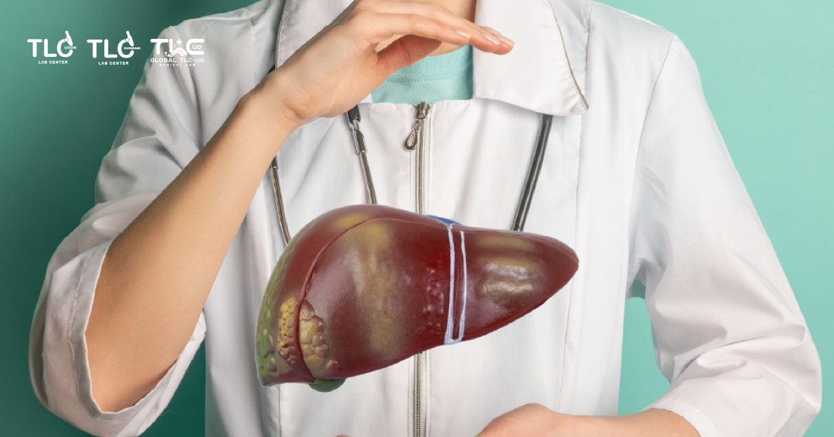 พังผืดในตับ - Liver fibrosis