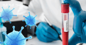 โกลบูลิน Globulin